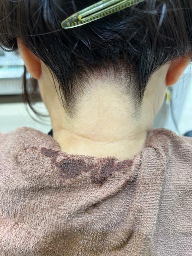うなじを綺麗に